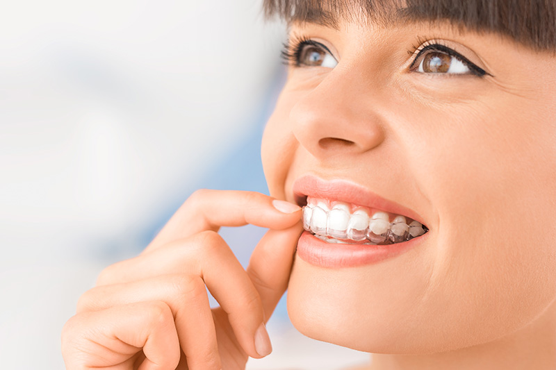 Invisalign in El Dorado Hills